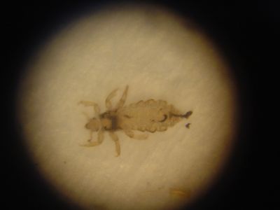 PV-0019
Photo Date: 8/23/2005
Photo Credit: Elizabeth Schultz
Description: Head lice in the microscope.
